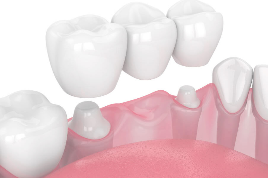 Treatment - Barhill Dental