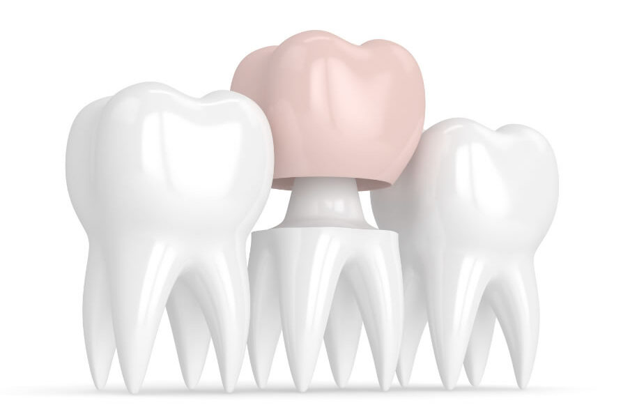 Treatment - Barhill Dental